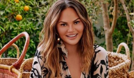 Chrissy Teigen Discloses That She Underwent Bichectomy